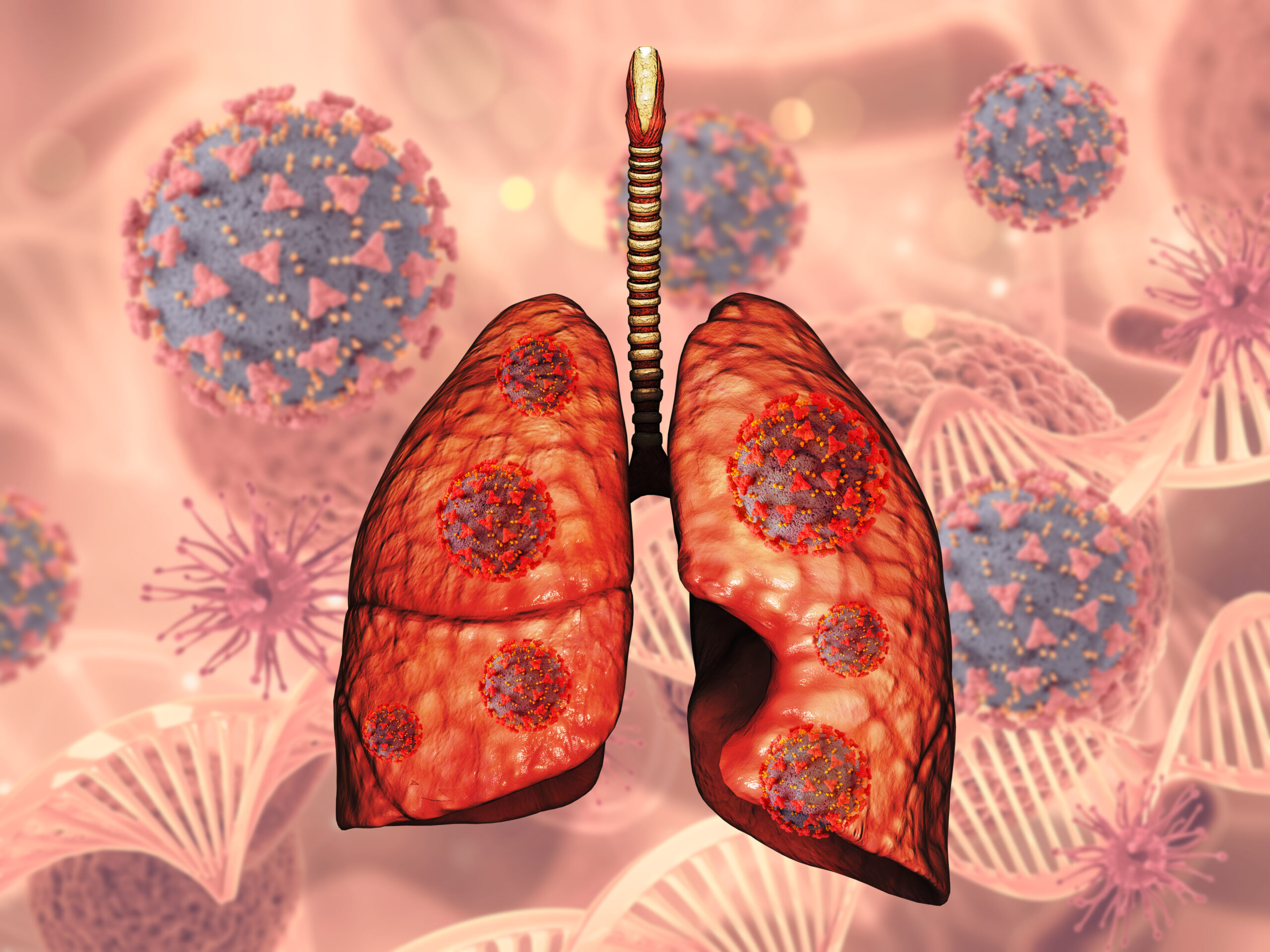 What are the symptoms of stage 4 lung cancer?