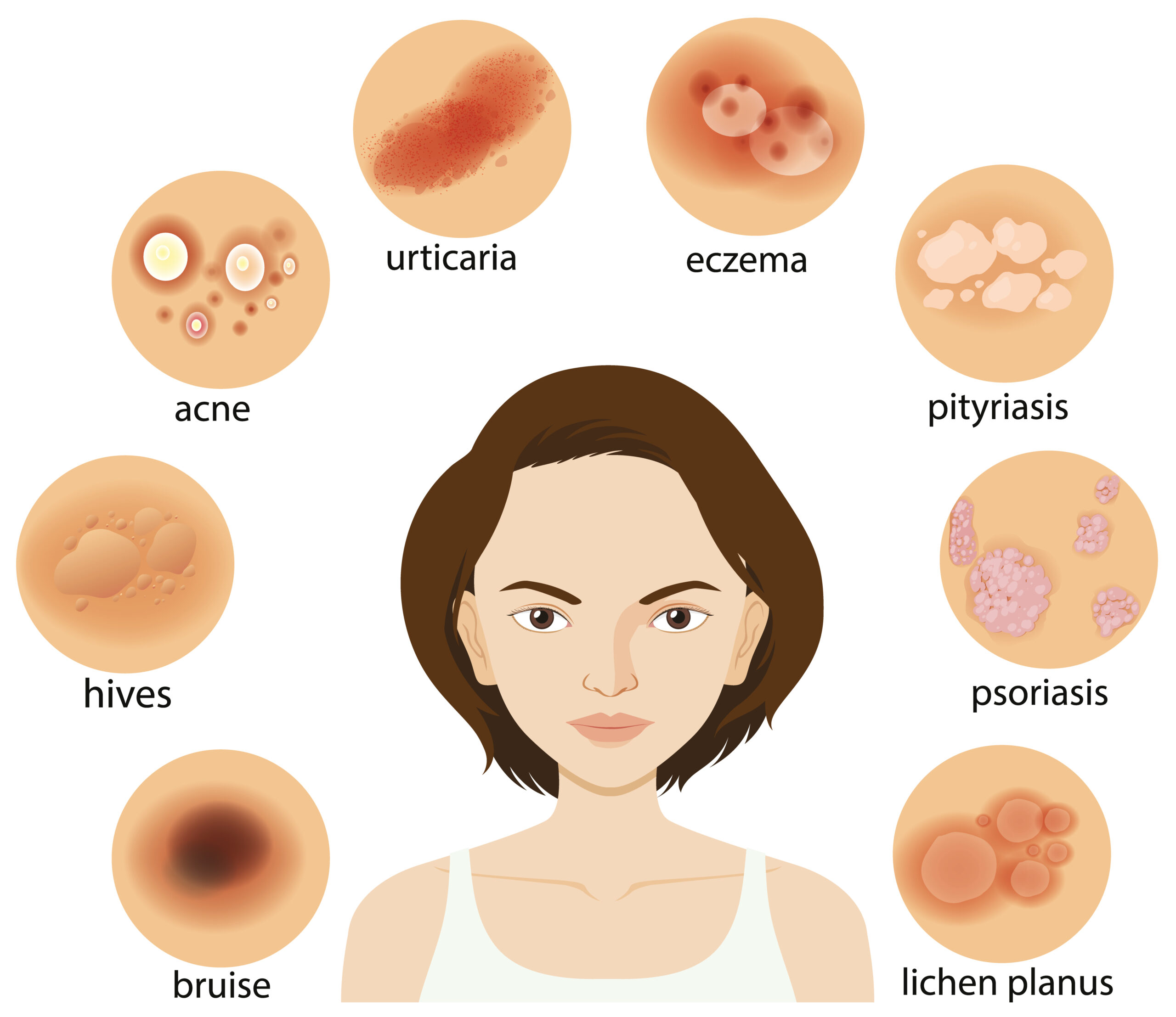 20 Types of Skin Lesions