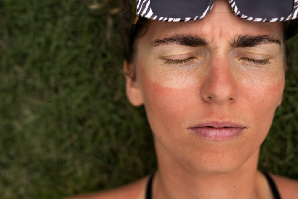 6 ways to avoid tanning during the summer